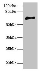 ARMCX2 Antibody - Western blot All lanes: ARMCX2 antibody at 5µg/ml Lane 1: Mouse brain tissue Lane 2: HepG2 whole cell lysate Lane 3: HCT116 whole cell lysate Lane 4: MCF-7 whole cell lysate Secondary Goat polyclonal to rabbit IgG at 1/10000 dilution Predicted band size: 66 kDa Observed band size: 66 kDa