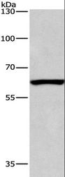 ARMCX2 Antibody - Western blot analysis of Mouse testis tissue, using ARMCX2 Polyclonal Antibody at dilution of 1:425.