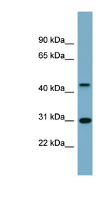 ARMCX3 Antibody - ARMCX3 antibody Western blot of Fetal Spleen lysate. This image was taken for the unconjugated form of this product. Other forms have not been tested.