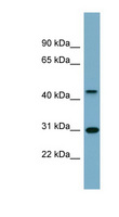 ARMCX3 Antibody - ARMCX3 antibody Western blot of Fetal Spleen lysate. This image was taken for the unconjugated form of this product. Other forms have not been tested.