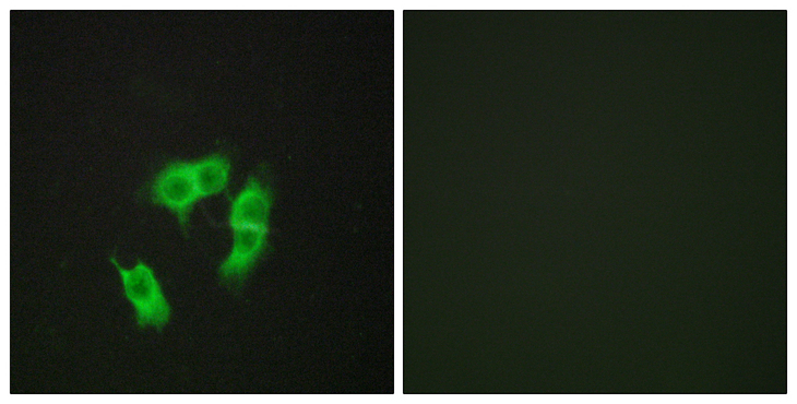 ARMCX3 Antibody - Immunofluorescence analysis of HepG2 cells, using ARMX3 Antibody. The picture on the right is blocked with the synthesized peptide.