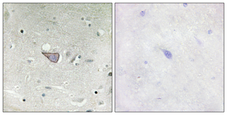 ARMCX3 Antibody - Immunohistochemistry analysis of paraffin-embedded human brain tissue, using ARMX3 Antibody. The picture on the right is blocked with the synthesized peptide.