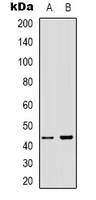 ARMCX3 Antibody - Western blot analysis of ARMCX3 expression in A431 (A); HEK293T (B) whole cell lysates.