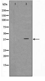 ARMCX3 Antibody - Western blot of K562 cell lysate using ARMX3 Antibody