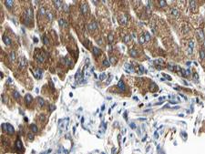 ARMCX3 Antibody - 1:100 staining human liver tissue by IHC-P. The tissue was formaldehyde fixed and a heat mediated antigen retrieval step in citrate buffer was performed. The tissue was then blocked and incubated with the antibody for 1.5 hours at 22°C. An HRP conjugated goat anti-rabbit antibody was used as the secondary.