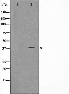 ARMCX3 Antibody - Western blot analysis on K562 cell lysates using ARMX3 antibody. The lane on the left is treated with the antigen-specific peptide.