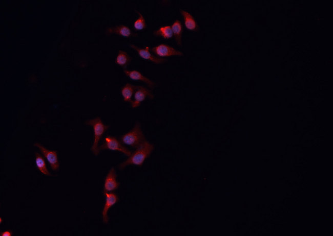 ARMCX3 Antibody - Staining HeLa cells by IF/ICC. The samples were fixed with PFA and permeabilized in 0.1% Triton X-100, then blocked in 10% serum for 45 min at 25°C. The primary antibody was diluted at 1:200 and incubated with the sample for 1 hour at 37°C. An Alexa Fluor 594 conjugated goat anti-rabbit IgG (H+L) Ab, diluted at 1/600, was used as the secondary antibody.
