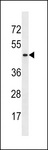 ARMCX4 Antibody - ARMCX4 Antibody western blot of HL-60 cell line lysates (35 ug/lane). The ARMCX4 antibody detected the ARMCX4 protein (arrow).
