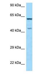 ARMCX5 Antibody - ARMCX5 antibody Western Blot of HeLa.  This image was taken for the unconjugated form of this product. Other forms have not been tested.