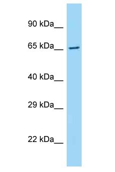 ARMCX5 Antibody - ARMCX5 antibody Western Blot of Fetal Liver. Antibody dilution: 1 ug/ml.  This image was taken for the unconjugated form of this product. Other forms have not been tested.