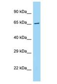 ARMCX5 Antibody - ARMCX5 antibody Western Blot of Fetal Liver. Antibody dilution: 1 ug/ml.  This image was taken for the unconjugated form of this product. Other forms have not been tested.
