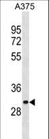 ARMCX6 Antibody - ARMCX6 Antibody western blot of A375 cell line lysates (35 ug/lane). The ARMCX6 antibody detected the ARMCX6 protein (arrow).