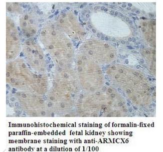 ARMCX6 Antibody - Immunohistochemistry of ARMCX6 antibody