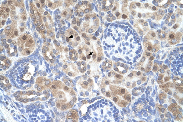 ARMCX6 Antibody - ARMCX6 antibody ARP44584_T100-NP_061880-ARMCX6(armadillo repeat containing, X-linked 6) Antibody IHC of formalin-fixed, paraffin-embedded human Kidney. Positive label: Epithelial cells of renal tubule indicated with arrows. Antibody concentration 4-8 ug/ml. Magnification 400X.  This image was taken for the unconjugated form of this product. Other forms have not been tested.