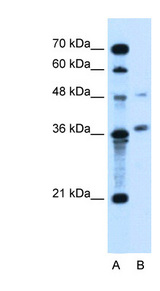 ARMCX6 Antibody - ARMCX6 antibody ARP44584_T100-NP_061880-ARMCX6(armadillo repeat containing, X-linked 6) Antibody Western blot of Jurkat lysate.  This image was taken for the unconjugated form of this product. Other forms have not been tested.
