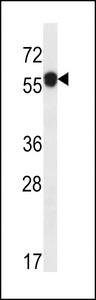ARMT1 Antibody - C6orf211 Antibody western blot of ZR-75-1 cell line lysates (35 ug/lane). The C6orf211 antibody detected the C6orf211 protein (arrow).
