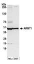 ARMT1 Antibody - Detection of human ARMT1 by western blot. Samples: Whole cell lysate (50 µg) from HeLa and 293T cells prepared using NETN lysis buffer. Antibody: Affinity purified rabbit anti-ARMT1 antibody used for WB at 1:1000. Detection: Chemiluminescence with an exposure time of 30 seconds.