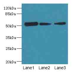 ARMT1 Antibody - Western blot. All lanes: ARMT1 antibody at 0.6 ug/ml. Lane 1: MCF7 whole cell lysate. Lane 2: A431 whole cell lysate. Lane 3: 293T whole cell lysate. Secondary Goat polyclonal to Rabbit IgG at 1:10000 dilution. Predicted band size: 51 kDa. Observed band size: 51 kDa.