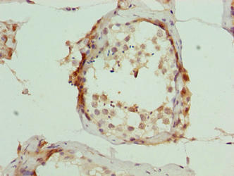 ARMT1 Antibody - Immunohistochemistry of paraffin-embedded human testis tissue using ARMT1 Antibody at dilution of 1:100