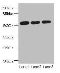 ARMT1 Antibody - Western blot All lanes: ARMT1 antibody at 0.6µg/ml Lane 1: MCF-7 whole cell lysate Lane 2: A431 whole cell lysate Lane 3: 293T whole cell lysate Secondary Goat polyclonal to rabbit IgG at 1/10000 dilution Predicted band size: 51 kDa Observed band size: 51 kDa