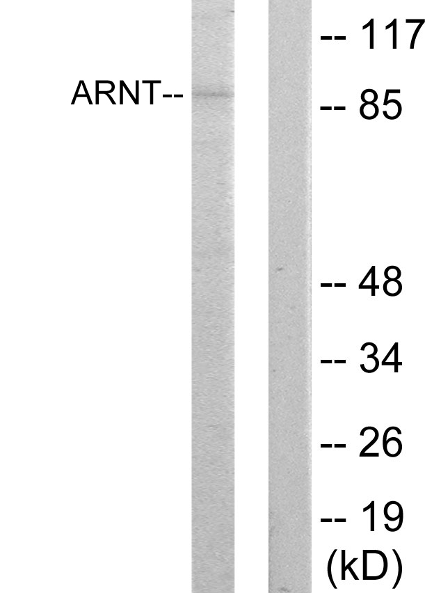 ARNT / HIF-1-Beta Antibody - Western blot analysis of lysates from HepG2 cells, using ARNT Antibody. The lane on the right is blocked with the synthesized peptide.