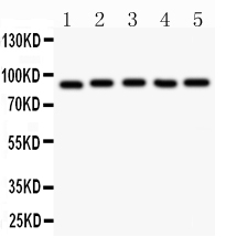 ARNT / HIF-1-Beta Antibody - Anti-HIF1 beta Picoband antibody, All lanes: Anti HIF1 beta at 0.5ug/ml Lane 1: Hela Whole Cell Lysate at 40ugLane 2: 293T Whole Cell Lysate at 40ugLane 3: Jurkat Whole Cell Lysate at 40ugLane 4: U87 Whole Cell Lysate at 40ug Lane5: Colo320 Whole Cell Lysate at 40ug Predicted bind size: 87KD Observed bind size: 87KD