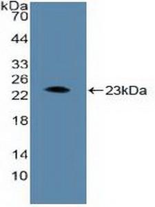 ARNT / HIF-1-Beta Antibody - Western Blot; Sample: Recombinant ARNT, Human.