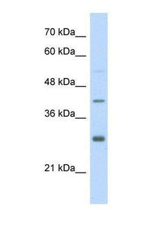 ARNT / HIF-1-Beta Antibody - Western blot of Human Jurkat. ARNT antibody dilution 1.0 ug/ml.  This image was taken for the unconjugated form of this product. Other forms have not been tested.