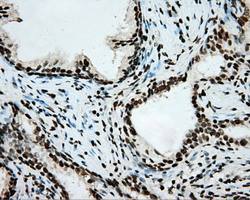 ARNT / HIF-1-Beta Antibody - IHC of paraffin-embedded Human prostate tissue using anti-ARNT mouse monoclonal antibody.