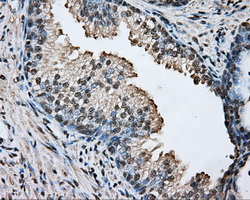 ARNT / HIF-1-Beta Antibody - IHC of paraffin-embedded prostate tissue using anti-ARNT mouse monoclonal antibody. (Dilution 1:50).