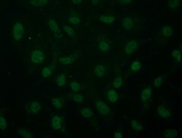 ARNT / HIF-1-Beta Antibody - Immunofluorescent staining of HeLa cells using anti-ARNT mouse monoclonal antibody.