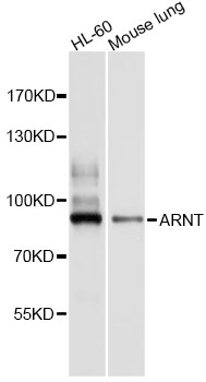 ARNT / HIF-1-Beta Antibody - Western blot analysis of extracts of various cell lines, using ARNT antibody at 1:1000 dilution. The secondary antibody used was an HRP Goat Anti-Rabbit IgG (H+L) at 1:10000 dilution. Lysates were loaded 25ug per lane and 3% nonfat dry milk in TBST was used for blocking. An ECL Kit was used for detection and the exposure time was 1s.
