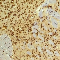 ARNT / HIF-1-Beta Antibody - Immunohistochemical analysis of HIF1 beta staining in mouse brain formalin fixed paraffin embedded tissue section. The section was pre-treated using heat mediated antigen retrieval with sodium citrate buffer (pH 6.0). The section was then incubated with the antibody at room temperature and detected using an HRP conjugated compact polymer system. DAB was used as the chromogen. The section was then counterstained with hematoxylin and mounted with DPX.