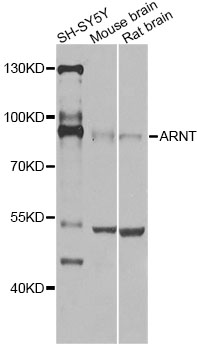 ARNT / HIF-1-Beta Antibody - Western blot analysis of extracts of various cell lines, using ARNT antibody at 1:1000 dilution. The secondary antibody used was an HRP Goat Anti-Rabbit IgG (H+L) at 1:10000 dilution. Lysates were loaded 25ug per lane and 3% nonfat dry milk in TBST was used for blocking. An ECL Kit was used for detection and the exposure time was 10s.