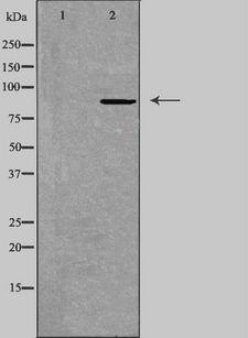 ARNT / HIF-1-Beta Antibody - Western blot analysis of extracts of HepG2 cells using ARNT antibody. The lane on the left is treated with the antigen-specific peptide.