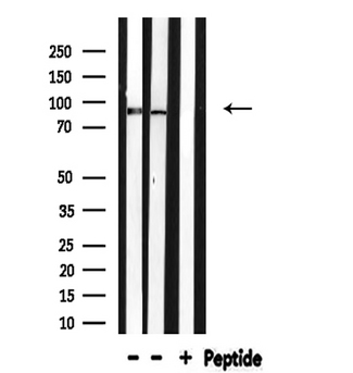 ARNT / HIF-1-Beta Antibody - Western blot analysis of ARNT expression in various lysates