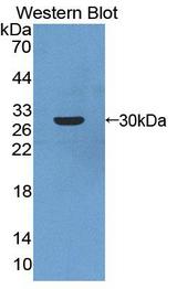 ARNT2 Antibody - Western blot of ARNT2 antibody.