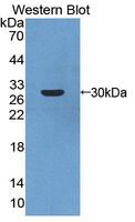 ARNT2 Antibody - Western blot of ARNT2 antibody.