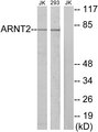 ARNT2 Antibody - Western blot analysis of lysates from Jurkat and 293 cells, using ARNT2 Antibody. The lane on the right is blocked with the synthesized peptide.