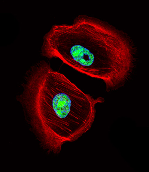 ARNT2 Antibody - Fluorescent confocal image of SK-BR-3 cell stained with ARNT2 Antibody. SK-BR-3 cells were fixed with 4% PFA (20 min), permeabilized with Triton X-100 (0.1%, 10 min), then incubated with ARNT2 primary antibody (1:25, 1 h at 37°C). For secondary antibody, Alexa Fluor 488 conjugated donkey anti-rabbit antibody (green) was used (1:400, 50 min at 37°C). Cytoplasmic actin was counterstained with Alexa Fluor 555 (red) conjugated Phalloidin (7units/ml, 1 h at 37°C). Nuclei were counterstained with DAPI (blue) (10 ug/ml, 10 min). ARNT2 immunoreactivity is localized to nucleus significantly.