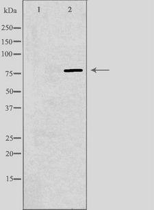 ARNT2 Antibody - Western blot analysis of extracts of Jurkat cells using ARNT2 antibody. The lane on the left is treated with the antigen-specific peptide.