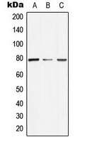 ARNT2 Antibody - Western blot analysis of ARNT2 expression in Jurkat (A); NIH3T3 (B); H9C2 (C) whole cell lysates.