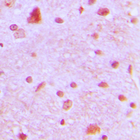 ARNT2 Antibody - Immunohistochemical analysis of ARNT2 staining in human brain formalin fixed paraffin embedded tissue section. The section was pre-treated using heat mediated antigen retrieval with sodium citrate buffer (pH 6.0). The section was then incubated with the antibody at room temperature and detected using an HRP conjugated compact polymer system. DAB was used as the chromogen. The section was then counterstained with hematoxylin and mounted with DPX.