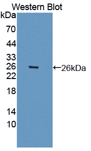 ARNTL / BMAL1 Antibody - Western blot of ARNTL / BMAL1 antibody.