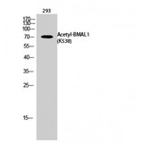 ARNTL / BMAL1 Antibody - Western blot of Acetyl-BMAL1 (K538) antibody