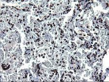 ARNTL / BMAL1 Antibody - IHC of paraffin-embedded Human lung tissue using anti-ARNTL mouse monoclonal antibody. (Heat-induced epitope retrieval by 1 mM EDTA in 10mM Tris, pH8.5, 120°C for 3min).