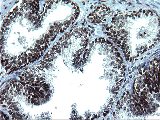 ARNTL / BMAL1 Antibody - IHC of paraffin-embedded Human prostate tissue using anti-ARNTL mouse monoclonal antibody. (Heat-induced epitope retrieval by 1 mM EDTA in 10mM Tris, pH8.5, 120°C for 3min).