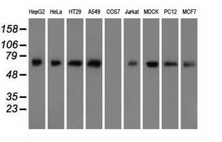 ARNTL / BMAL1 Antibody - Western blot analysis of extracts (35ug) from 9 different cell lines by using anti-ARNTL monoclonal antibody.