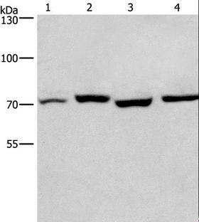 ARNTL / BMAL1 Antibody - Western blot analysis of Human fetal liver and mouse stomach tissue, HeLa and hepG2 cell, using ARNTL Polyclonal Antibody at dilution of 1:450.