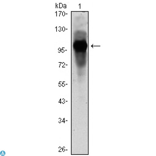 ARNTL / BMAL1 Antibody - Immunohistochemistry (IHC) analysis of paraffin-embedded Human Spleen tissues with AEC staining using BMAL1 Monoclonal Antibody.